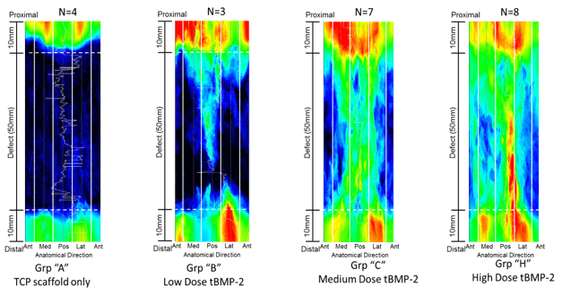 Bone Formation